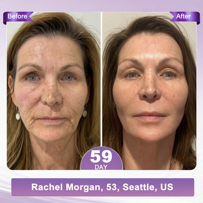 𝐇𝐈𝐒𝐊𝐈𝐍® Only 10 Boxes!!! Get an exclusive 80% OFF now. ✨ See visible firming in just 7 days! ✔️ Backed by our 180-day money-back guarantee.