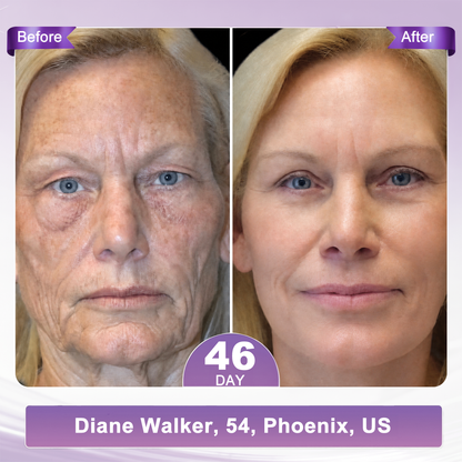 𝐇𝐈𝐒𝐊𝐈𝐍® Only 10 Boxes!!! Get an exclusive 80% OFF now. ✨ See visible firming in just 7 days! ✔️ Backed by our 180-day money-back guarantee.
