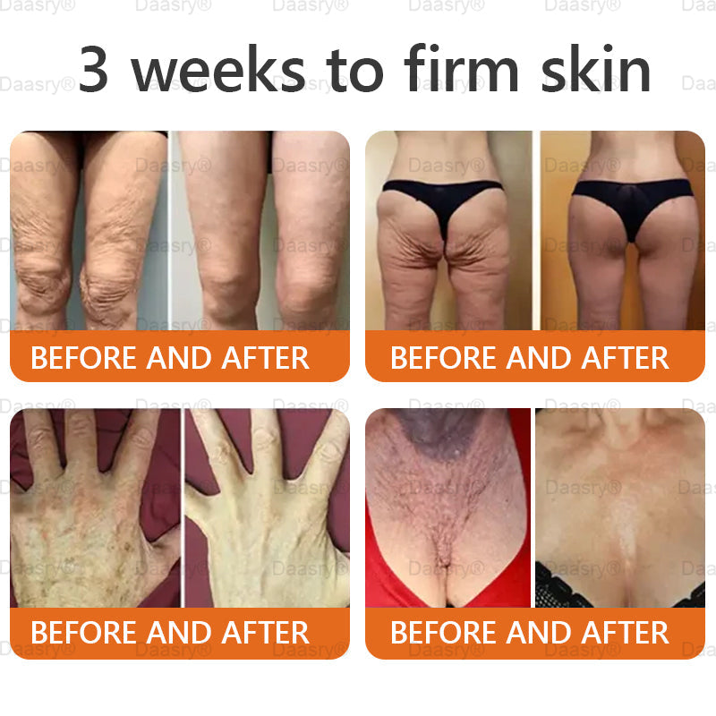 FDA Official: Daasry® Botox Bee Venom Skin Restoration Cream - Anti-aging, Hydrating, Skin Firming & Lifting, Skin Repair, Even Tone, Acne and Dark Spot Treatment, Wart and Mole Removal, and Psoriasis Relief.