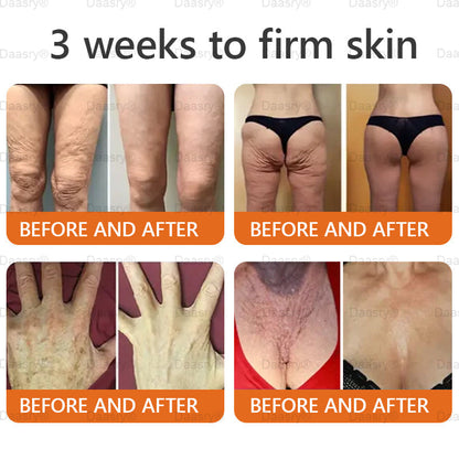 FDA Official: Daasry® Botox Bee Venom Skin Restoration Cream - Anti-aging, Hydrating, Skin Firming & Lifting, Skin Repair, Even Tone, Acne and Dark Spot Treatment, Wart and Mole Removal, and Psoriasis Relief.