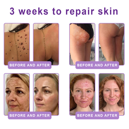 𝐇𝐈𝐒𝐊𝐈𝐍® Only 10 Boxes!!! Get an exclusive 80% OFF now. ✨ See visible firming in just 7 days! ✔️ Backed by our 180-day money-back guarantee.