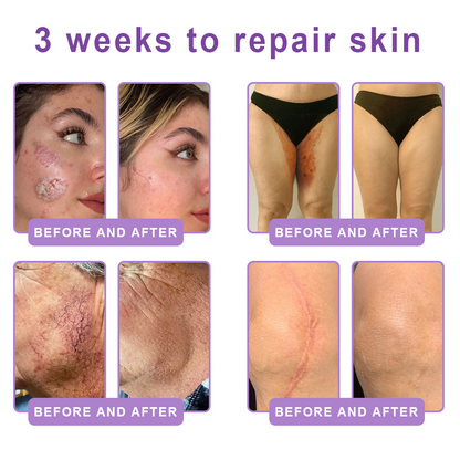 𝐇𝐈𝐒𝐊𝐈𝐍® Only 10 Boxes!!! Get an exclusive 80% OFF now. ✨ See visible firming in just 7 days! ✔️ Backed by our 180-day money-back guarantee.