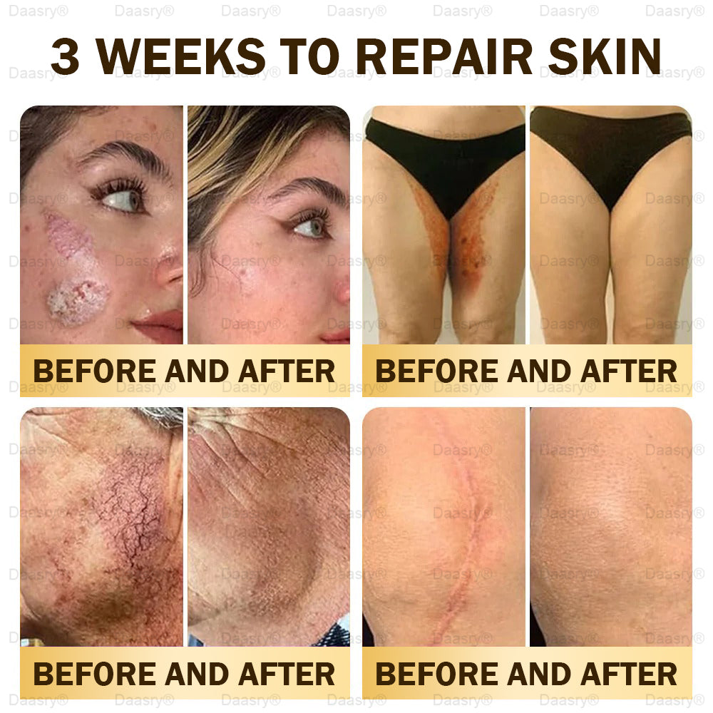 🎁Daasry® Bee Venom Skin Repair & Anti-Aging Cream, Wrinkle Reduction, Hydrating, Brightening, Scar Healing, Sensitive Skin Relief, Even Tone