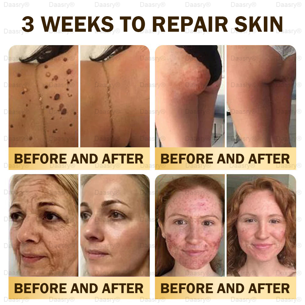 🎁Daasry® Bee Venom Skin Repair & Anti-Aging Cream, Wrinkle Reduction, Hydrating, Brightening, Scar Healing, Sensitive Skin Relief, Even Tone