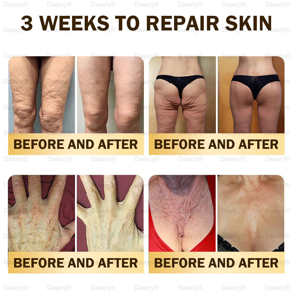 🎁Daasry® Bee Venom Skin Repair & Anti-Aging Cream, Wrinkle Reduction, Hydrating, Brightening, Scar Healing, Sensitive Skin Relief, Even Tone