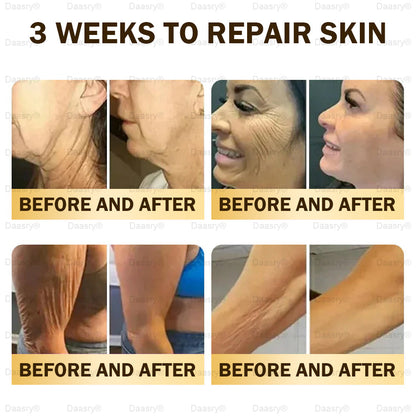 🎁Daasry® Bee Venom Skin Repair & Anti-Aging Cream, Wrinkle Reduction, Hydrating, Brightening, Scar Healing, Sensitive Skin Relief, Even Tone