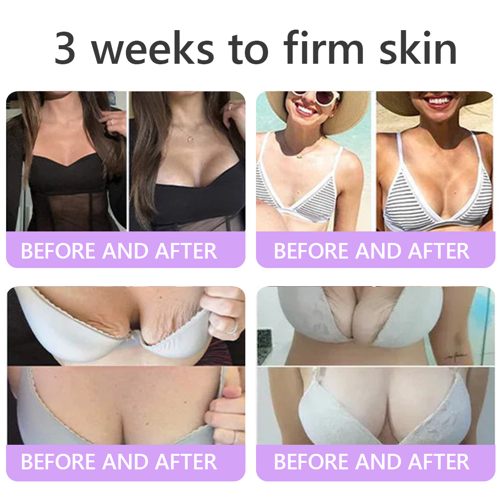𝐇𝐈𝐒𝐊𝐈𝐍® Only 10 Boxes!!! Get an exclusive 80% OFF now. ✨ See visible firming in just 7 days! ✔️ Backed by our 180-day money-back guarantee.