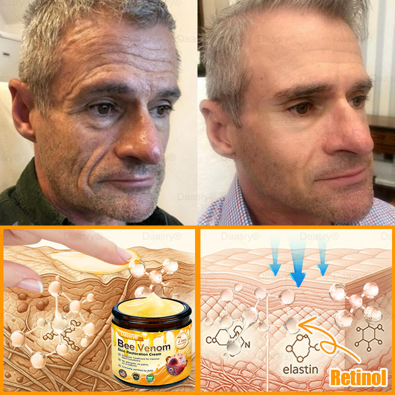 FDA Official: Daasry® Botox Bee Venom Skin Restoration Cream - Anti-aging, Hydrating, Skin Firming & Lifting, Skin Repair, Even Tone, Acne and Dark Spot Treatment, Wart and Mole Removal, and Psoriasis Relief.