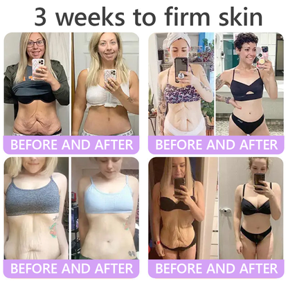 𝐇𝐈𝐒𝐊𝐈𝐍® Only 10 Boxes!!! Get an exclusive 80% OFF now. ✨ See visible firming in just 7 days! ✔️ Backed by our 180-day money-back guarantee.