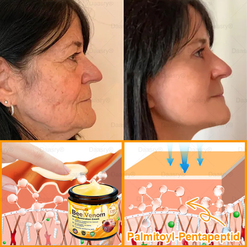 FDA Official: Daasry® Botox Bee Venom Skin Restoration Cream - Anti-aging, Hydrating, Skin Firming & Lifting, Skin Repair, Even Tone, Acne and Dark Spot Treatment, Wart and Mole Removal, and Psoriasis Relief.