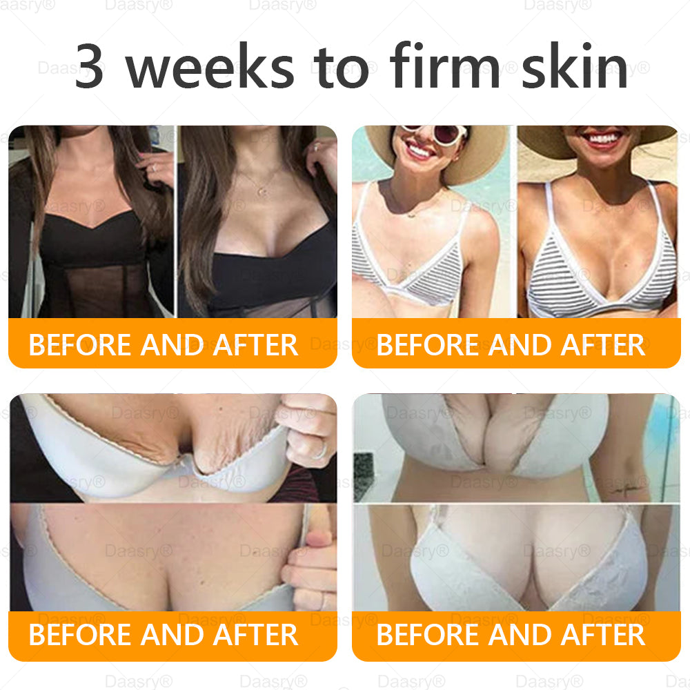FDA Official: Daasry® Botox Bee Venom Skin Restoration Cream - Anti-aging, Hydrating, Skin Firming & Lifting, Skin Repair, Even Tone, Acne and Dark Spot Treatment, Wart and Mole Removal, and Psoriasis Relief.
