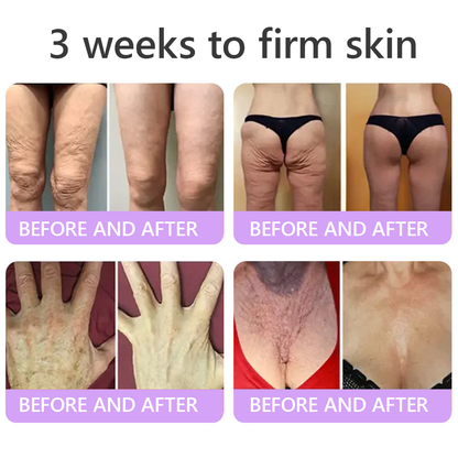 𝐇𝐈𝐒𝐊𝐈𝐍® Only 10 Boxes!!! Get an exclusive 80% OFF now. ✨ See visible firming in just 7 days! ✔️ Backed by our 180-day money-back guarantee.