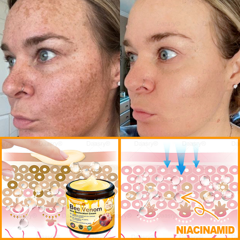FDA Official: Daasry® Botox Bee Venom Skin Restoration Cream - Anti-aging, Hydrating, Skin Firming & Lifting, Skin Repair, Even Tone, Acne and Dark Spot Treatment, Wart and Mole Removal, and Psoriasis Relief.