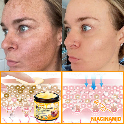 FDA Official: Daasry® Botox Bee Venom Skin Restoration Cream - Anti-aging, Hydrating, Skin Firming & Lifting, Skin Repair, Even Tone, Acne and Dark Spot Treatment, Wart and Mole Removal, and Psoriasis Relief.
