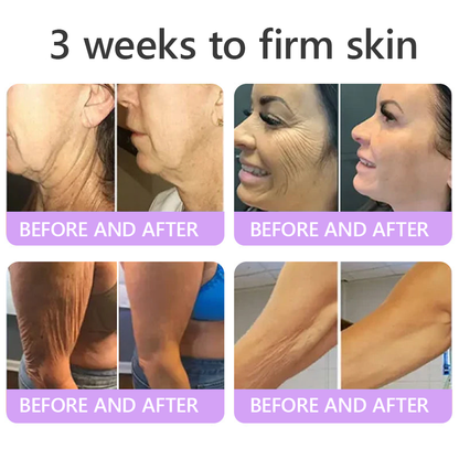 𝐇𝐈𝐒𝐊𝐈𝐍® Only 10 Boxes!!! Get an exclusive 80% OFF now. ✨ See visible firming in just 7 days! ✔️ Backed by our 180-day money-back guarantee.