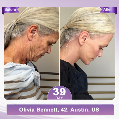 𝐇𝐈𝐒𝐊𝐈𝐍® Only 10 Boxes!!! Get an exclusive 80% OFF now. ✨ See visible firming in just 7 days! ✔️ Backed by our 180-day money-back guarantee.